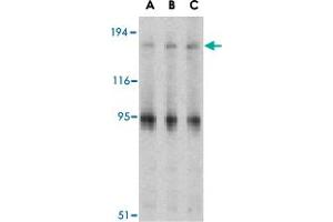 Western blot analysis of IRS1 in PC-3 cell lysate with IRS1 polyclonal antibody  at (A) 1, (B) 2 and (C) 4 ug/mL . (IRS1 Antikörper  (Internal Region))