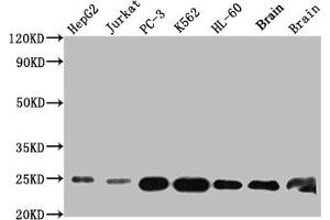 Western Blot Positive WB detected in: HepG2 whole cell lysate, Jurkat whole cell lysate, PC-3 whole cell lysate, K562 whole cell lysate, HL-60 whole cell lysate, Mouse Brain whole cell lysate, Rat Brain whole cell lysate All lanes: GSTP1 antibody at 1:1000 Secondary Goat polyclonal to rabbit IgG at 1/50000 dilution Predicted band size: 24 kDa Observed band size: 24 kDa