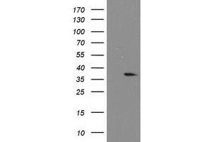 Western Blotting (WB) image for anti-Nucleotide Binding Protein-Like (NUBPL) (AA 1-250) antibody (ABIN1490631) (NUBPL Antikörper  (AA 1-250))