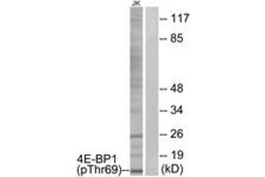 Western blot analysis of extracts from Jurkat cells treated with EGF 200ng/ml 30', using 4E-BP1 (Phospho-Thr69) Antibody.