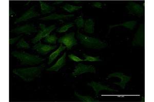 Immunofluorescence of monoclonal antibody to IL15 on HeLa cell.