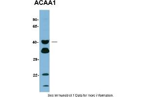 Sample Type: Human LiverPrimary Dilution: 1:1000Gel concentration: 12% (ACAA1 Antikörper  (N-Term))