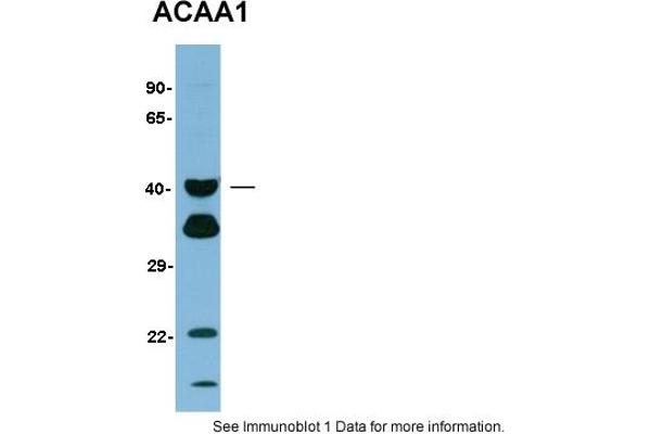 ACAA1 Antikörper  (N-Term)