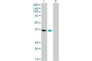 Western Blot analysis of ZFP36L1 expression in transfected 293T cell line by ZFP36L1 monoclonal antibody (M02), clone 1A3. (ZFP36L1 Antikörper  (AA 1-108))