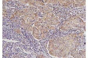 IHC analysis of VTCN1 using anti-VTCN1 antibody (ABIN7602060).
