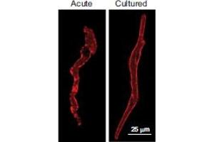 Expression of HCN4 in mouse sinoatrial myocytes.