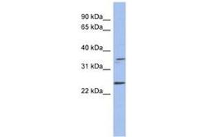 Image no. 1 for anti-Necdin Homolog (Mouse) (NDN) (AA 179-228) antibody (ABIN6744060) (NDN Antikörper  (AA 179-228))