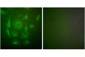 Immunofluorescence (IF) image for anti-Keratin 7 (KRT7) (AA 420-469) antibody (ABIN1533327)