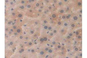 DAB staining on IHC-P; Samples: Mouse Liver Tissue (APP Antikörper  (AA 672-711))