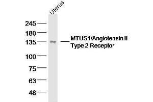 Mouse uterus lysates probed with MTUS1 Polyclonal Antibody, unconjugated  at 1:300 overnight at 4°C followed by a conjugated secondary antibody for 60 minutes at 37°C. (MTUS1 Antikörper  (AA 1151-1270))