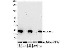 Western Blotting (WB) image for anti-Ubiquitin Carboxyl-terminal Esterase L1 (Ubiquitin Thiolesterase) (UCHL1) (AA 50-100) antibody (ABIN7449527) (Rekombinanter UCHL1 Antikörper  (AA 50-100))