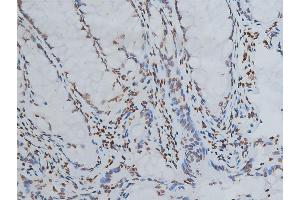 ABIN6267039 at 1/200 staining human colon tissue sections by IHC-P. (Histone 3 Antikörper)