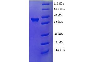 SDS-PAGE (SDS) image for RNA Binding Motif Protein 9 (RBM9) (AA 1-380) protein (His tag) (ABIN5710222) (RBM9 Protein (AA 1-380) (His tag))