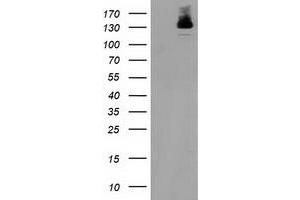 Western Blotting (WB) image for anti-Histone Deacetylase 6 (HDAC6) antibody (ABIN1498618) (HDAC6 Antikörper)