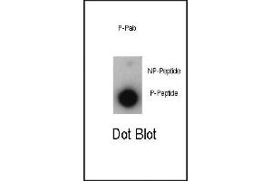 Dot blot analysis of anti-Phospho-P21CIP1-T57 Antibody (ABIN389613 and ABIN2839617) on nitrocellulose membrane. (p21 Antikörper  (pThr57))