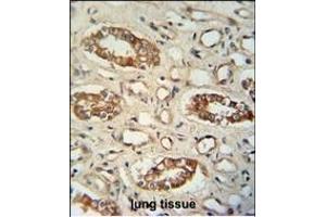 M1L antibody (C-term) (ABIN654954 and ABIN2844594) immunohistochemistry analysis in formalin fixed and paraffin embedded human lung tissue followed by peroxidase conjugation of the secondary antibody and DAB staining. (PPM1L Antikörper  (C-Term))