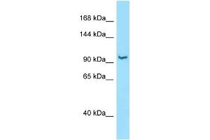 WB Suggested Anti-Rbm25 Antibody   Titration: 1. (RBM25 Antikörper  (Middle Region))