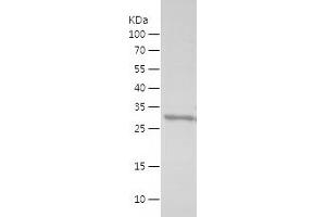 FUS Protein (AA 287-376) (His-IF2DI Tag)