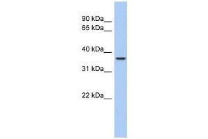 Aquaporin 10 antibody used at 1 ug/ml to detect target protein. (Aquaporin 10 Antikörper  (Middle Region))