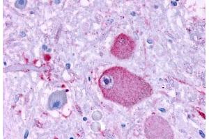 Anti-GPR37 antibody  ABIN1048808 IHC staining of human brain, neurons and glia. (GPR37 Antikörper  (N-Term))