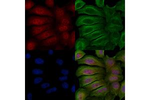 ABIN6256394 and ABIN6267617 staining Hela cells(20 min of 30uM Forskolin treatment) by IF/ICC. (PKC delta Antikörper  (pSer645))