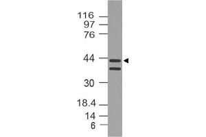 Image no. 1 for anti-DNA (Cytosine-5-)-Methyltransferase 3 Like (TRDMT1) (AA 120-350) antibody (ABIN5027164)