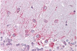 Immunohistochemistry with Brain, cerebellum tissue at an antibody concentration of 5µg/ml using anti-PSEN1 antibody (ARP44201_P050) (Presenilin 1 Antikörper  (N-Term))