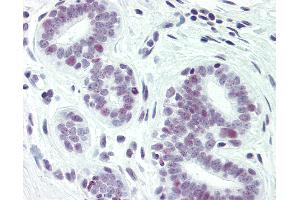 Anti-PAX2 antibody IHC of human breast. (PAX2A Antikörper  (pSer393))