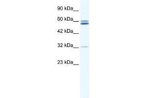 WB Suggested Anti-ZNF491 Antibody Titration:  0. (ZNF491 Antikörper  (N-Term))