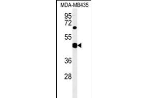 SH2D2A Antibody (Center) (ABIN651523 and ABIN2840277) western blot analysis in MDA-M cell line lysates (35 μg/lane). (SH2D2A Antikörper  (AA 86-112))