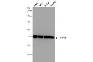 WB Image GRP75 antibody detects GRP75 protein by western blot analysis. (HSPA9 Antikörper  (Center))