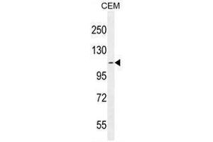 AT8B2 Antibody (N-term) western blot analysis in CEM cell line lysates (35µg/lane).