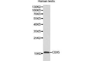 Western Blotting (WB) image for anti-Lysozyme-Like 6 (LYZL6) (AA 20-148) antibody (ABIN3021348) (LYZL6 Antikörper  (AA 20-148))