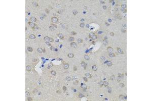 Immunohistochemistry (IHC) image for anti-Aconitase 1 (ACO1) antibody (ABIN1877037)