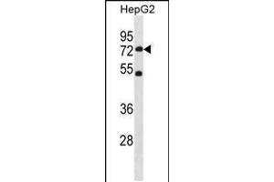 Western blot analysis in HepG2 cell line lysates (35ug/lane). (SETD3 Antikörper  (C-Term))