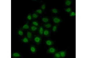 Immunofluorescence (IF) image for anti-TEA Domain Family Member 1 (SV40 Transcriptional Enhancer Factor) (TEAD1) (AA 135-215) antibody (ABIN6148982)