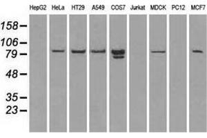 Western blot analysis of extracts (35 µg) from 9 different cell lines by using anti-STAT1 monoclonal antibody. (STAT1 Antikörper)