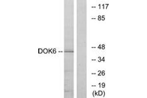 Western blot analysis of extracts from COLO cells, using DOK6 Antibody.