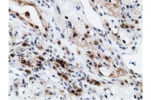 Image no. 16 for anti-EPM2A (Laforin) Interacting Protein 1 (EPM2AIP1) antibody (ABIN1498047) (EPM2AIP1 Antikörper)