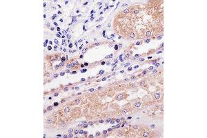 Immunohistochemical analysis of paraffin-embedded H. (PPP2R2A Antikörper  (N-Term))
