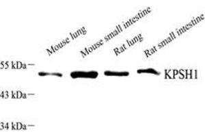 Western blot analysis of PSKH1 (ABIN7075291),at dilution of 1: 1500,Lane 1: Mouse lung tissue lysate,Lane 2: Mouse small intestine tissue lysate,Lane 3: Rat lung tissue lysate,Lane 4: Rat small intestine tissue lysate (PSKH1 Antikörper)