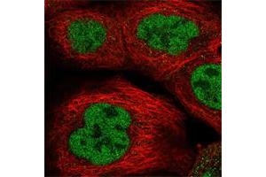 Immunofluorescent staining of human cell line A-431 shows positivity in nucleus but not nucleoli. (RREB1 Antikörper)