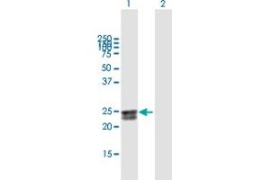 Western Blot analysis of FLJ20397 expression in transfected 293T cell line by FLJ20397 MaxPab polyclonal antibody.