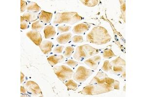 Immunohistochemistry of paraffin embedded mouse Skeletal muscle using Igfn1 (ABIN7074278) at dilution of 1:700 (400x lens) (IGFN1 Antikörper)