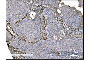 IHC analysis of TAGLN/Transgelin using anti-TAGLN/Transgelin antibody (ABIN7600099).