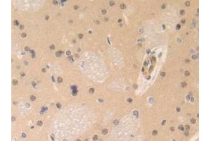 DAB staining on IHC-P; Samples: Rat Brain Tissue (CENPE Antikörper  (AA 2222-2361))