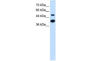 WB Suggested Anti-MMP1 Antibody Titration:  2.