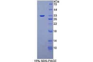 SDS-PAGE (SDS) image for Protein Kinase N1 (PKN1) (AA 615-874) protein (His tag) (ABIN2126522)