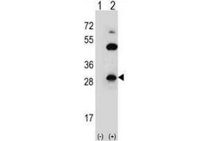 Western blot analysis of CLDN2 (arrow) using rabbit polyclonal CLDN2 Antibody (pTyr224) . (Claudin 2 Antikörper  (C-Term))