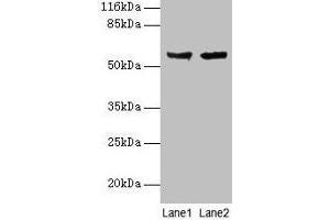 Western blot All lanes: CYP17A1 antibody at 2 μg/mL Lane 1: Hela whole cell lysate Lane 2: A549 whole cell lysate Secondary Goat polyclonal to rabbit IgG at 1/10000 dilution Predicted band size: 58 kDa Observed band size: 58 kDa (CYP17A1 Antikörper  (AA 1-508))